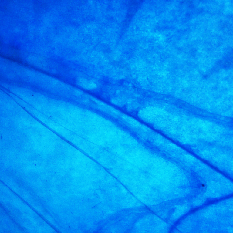 organic-abstract-photography-blue-fragile-tissues